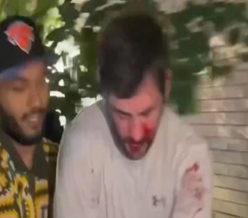 流氓行为！昨日一马刺球迷被围殴到满脸是血，被要求脱球衣才能走